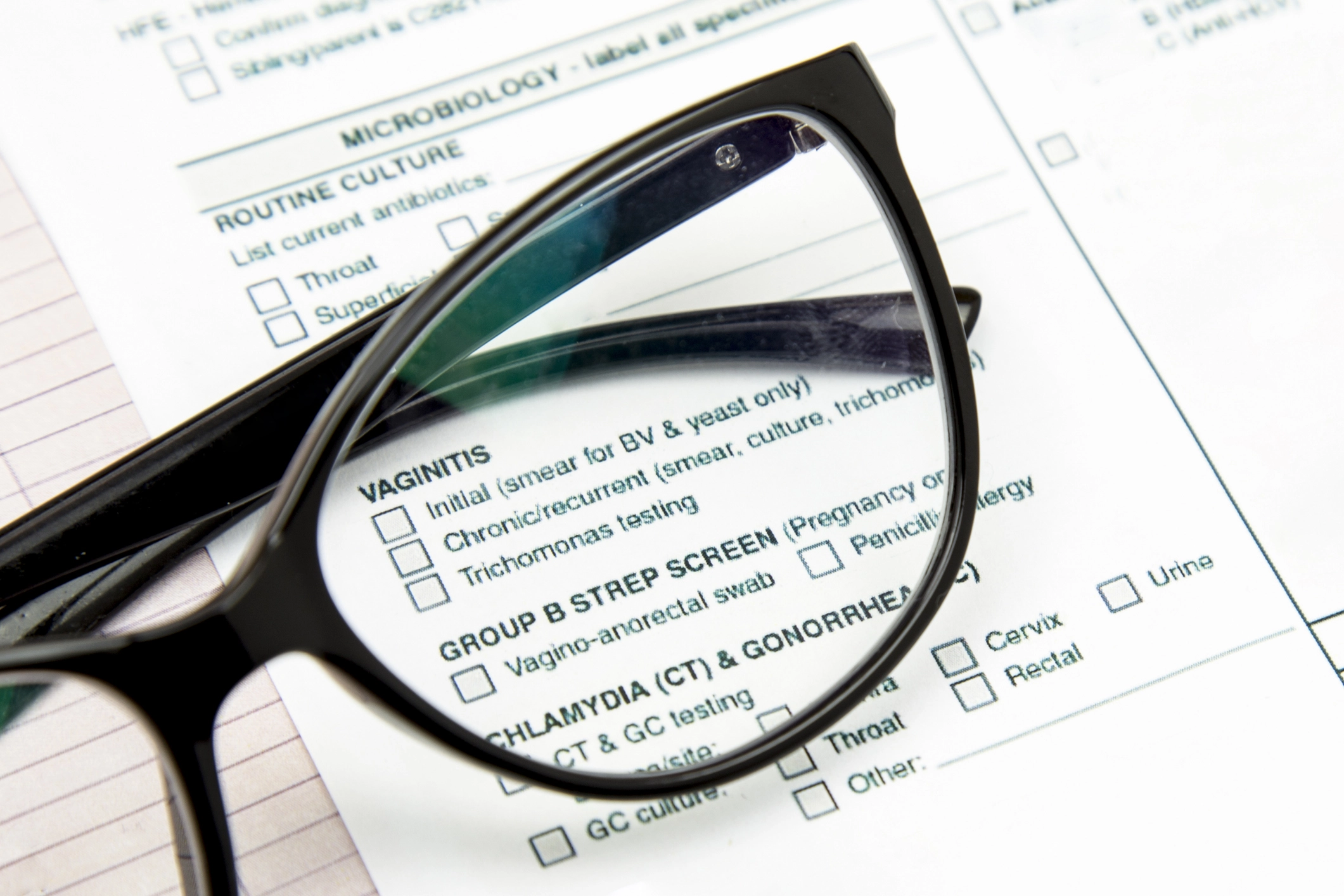 Occhiali da vista posti sopra una cartella clinica